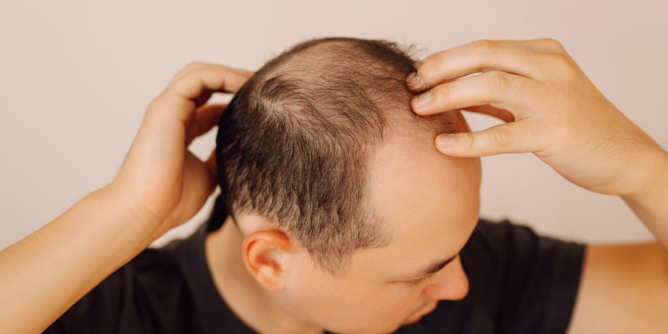 Ancient Chinese Medicine May Hold the Key to Hair Regrowth: What Modern Science Is Discovering