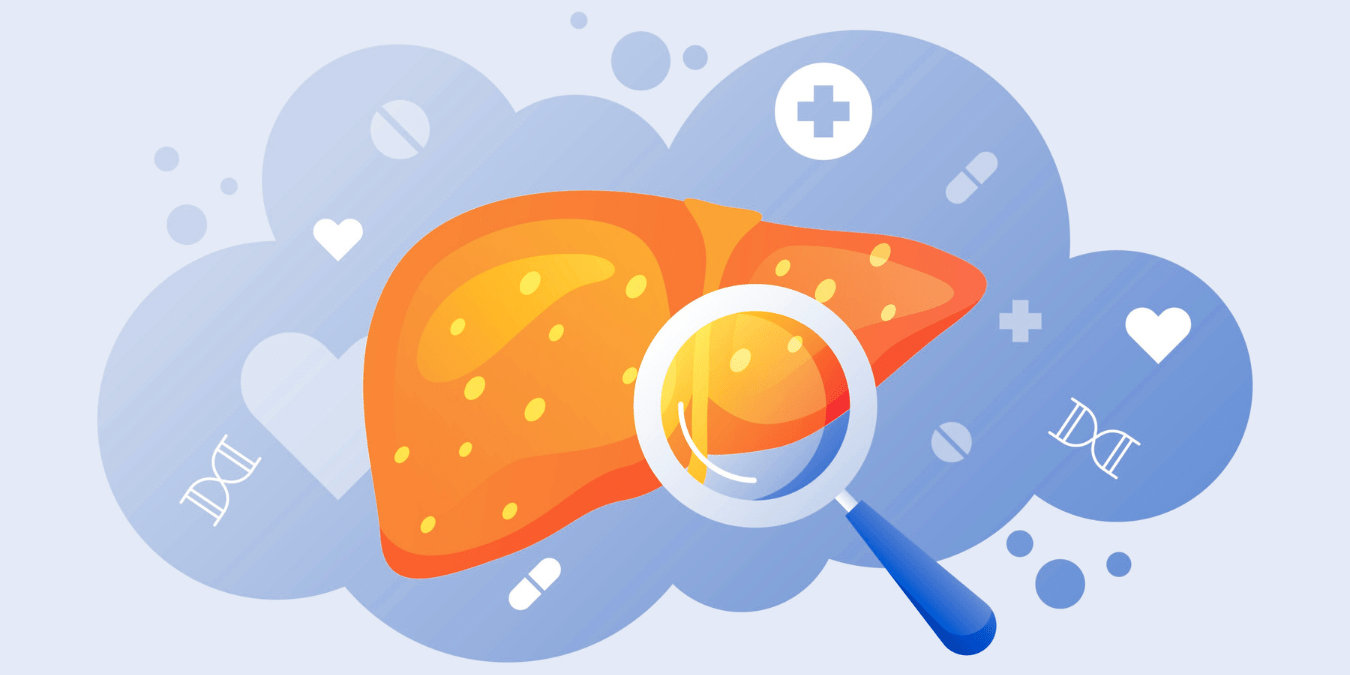 How to Reverse Fatty Liver Naturally with a 7-Day Mediterranean Meal Plan for Busy Americans