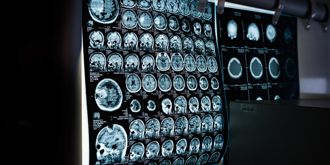 This AI Model Can Read Cardiac MRI Scans as Accurately as a Specialist — And It Works in Minutes