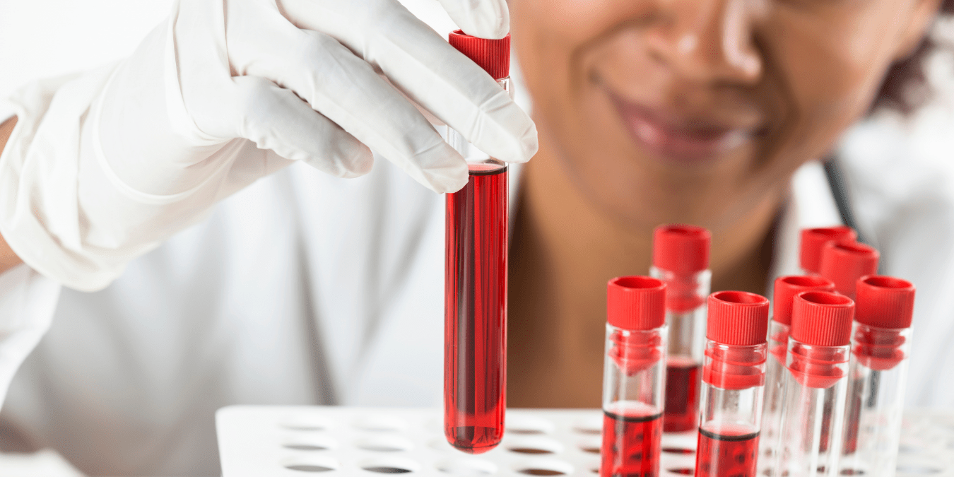 Washington University’s New Alzheimer’s Blood Test Can Predict Memory Loss Years Before It Happens