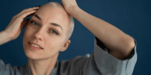 37% of Women Over 65 Are Losing Hair — But the Real Shocker Is How Many Younger Women Are Now Using These FDA-Approved At-Home Treatments to Stop It Early