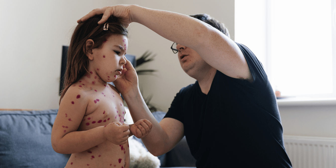 Your Child’s School Could Be Ground Zero: The Hidden Measles Outbreaks Spreading Across 33 States That Most American Parents Have No Idea About